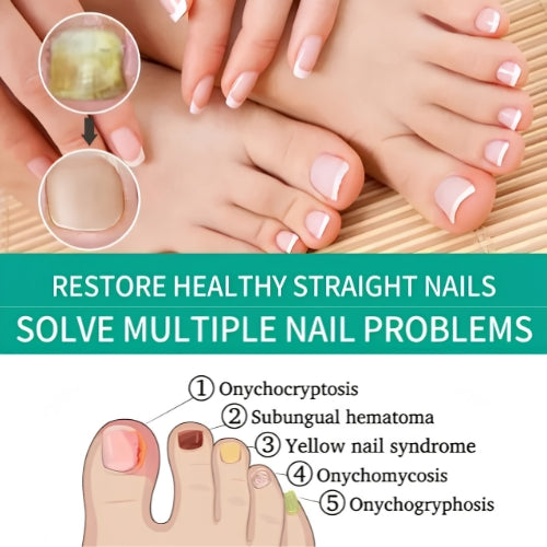 Nail Fungus Oil