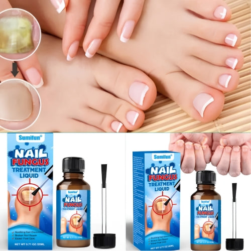 Nail Fungus Oil
